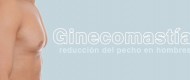 ginecomastia